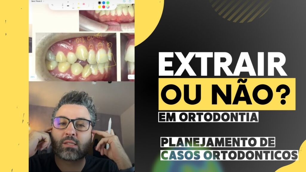 extração em ortodontia