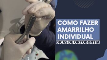 Como Fazer um Amarrilho Individual em Ortodontia: Guia Passo a Passo