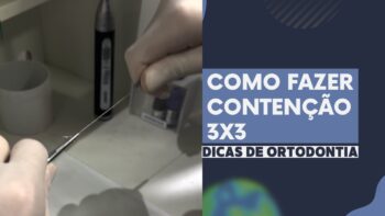 Como Fazer uma Contenção 3×3: Guia Completo para Ortodontistas